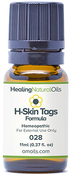 Healing Natural Oils Skin tags