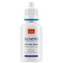 AcneVit Anti-Acne Serum 8