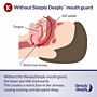 Sleeply Deeply Male Anti Snoring EasyFit Mouth Guard 6