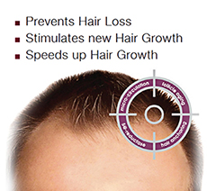 nutrigrow prevents hair loss